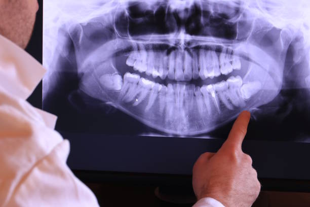 Best Same-Day Emergency Dental Services in Van, TX