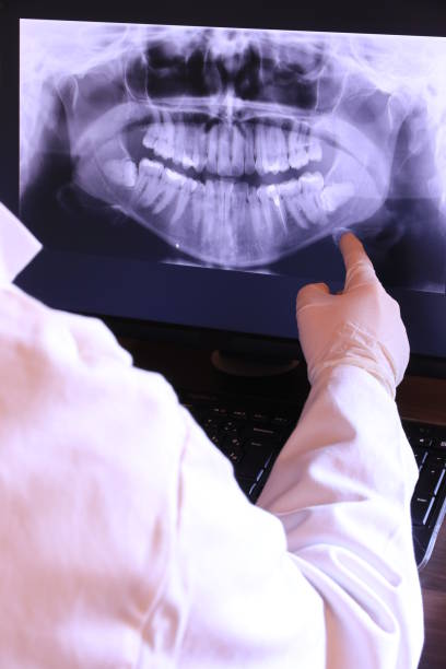 Best Emergency Tooth Extraction in Van, TX
